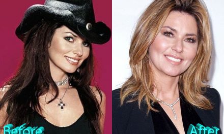 Shania Twain Plastic Surgery: A New Look For A New Start