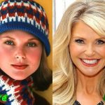 christie brinkley before and after plastic surgery 150x150
