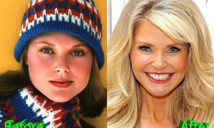 Christie Brinkley Plastic Surgery : The Lovely Fashion Princess