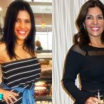 Claudia Sierra Before and After Cosmetic Surgery 150x150