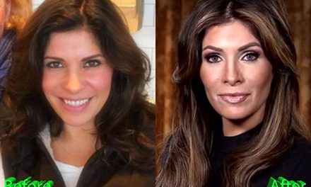 Claudia Sierra Plastic Surgery: A Melania Lookalike, Really?