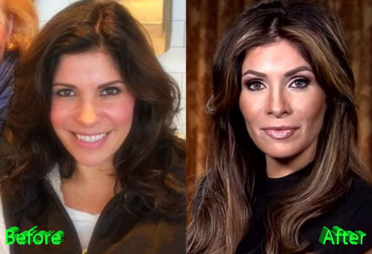 Claudia Sierra Plastic Surgery: A Melania Lookalike, Really?