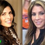 Claudia Sierra Before and After Surgery Procedure