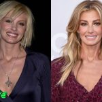 Faith Hill Before and After Plastic Surgery