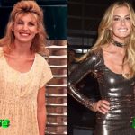 Faith Hill Before and After Surgery Procedure