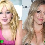 Hilary Duff Before and After Cosmetic Surgery 150x150