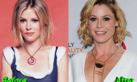 Julie Bowen Plastic Surgery: Still Looking Flawless