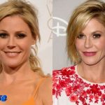 Julie Bowen Before and After Plastic Surgery