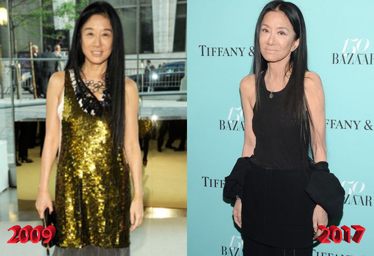 Vera Wang Before and After Cosmetic Surgery