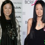 Vera Wang Before and After Surgery Procedure 150x150