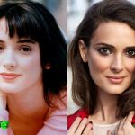 Winona Ryder Before and After Surgery Procedure 150x150
