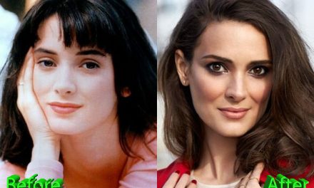 Winona Ryder Plastic Surgery: Silky Smooth Skin For Winona