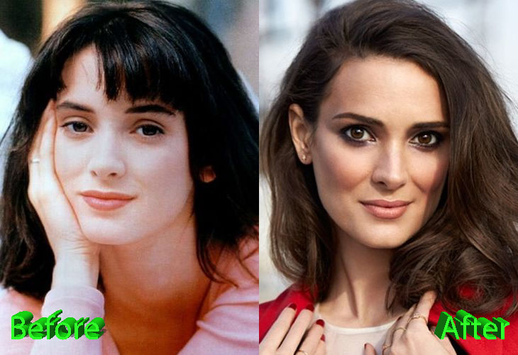 Winona Ryder Plastic Surgery: Silky Smooth Skin For Winona