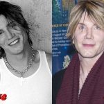John Rzeznik Before and After Cosmetic Surgery