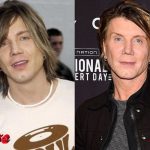John Rzeznik Before and After Plastic Surgery 150x150