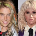 Kesha Before and After Plastic Surgery 150x150