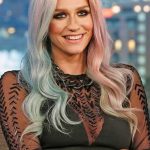 Kesha Plastic Surgery Rumors 150x150