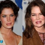 Lara Flynn Boyle Before and After Multiple Plastic Surgeries 150x150