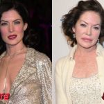 Lara Flynn Boyle Before and After Plastic Surgery 150x150
