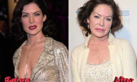 Lara Flynn Boyle Plastic Surgery: A Multiple Surgery Story