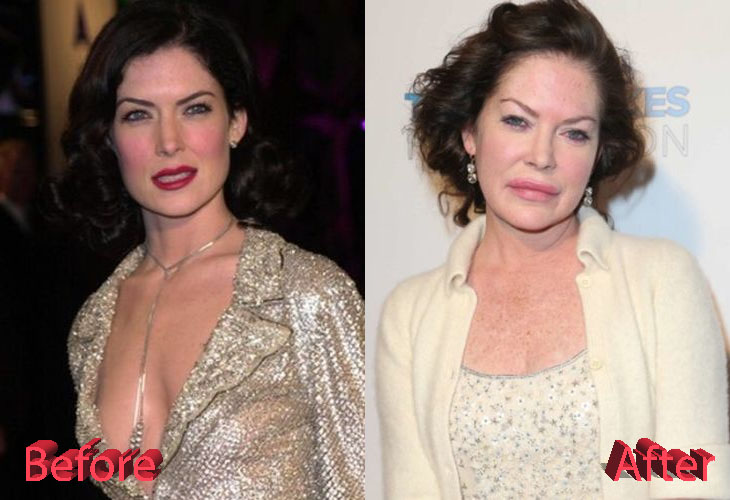 Lara Flynn Boyle Plastic Surgery: A Multiple Surgery Story