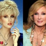 Morgan Fairchild Before and After Cosmetic Surgery 150x150