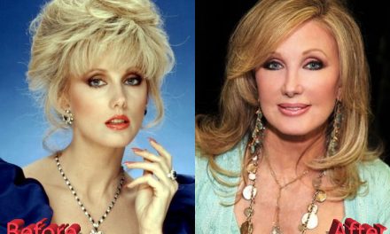 Morgan Fairchild Plastic Surgery: A Beautiful Soap Opera Queen