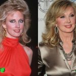 Morgan Fairchild Before and After Plastic Surgery