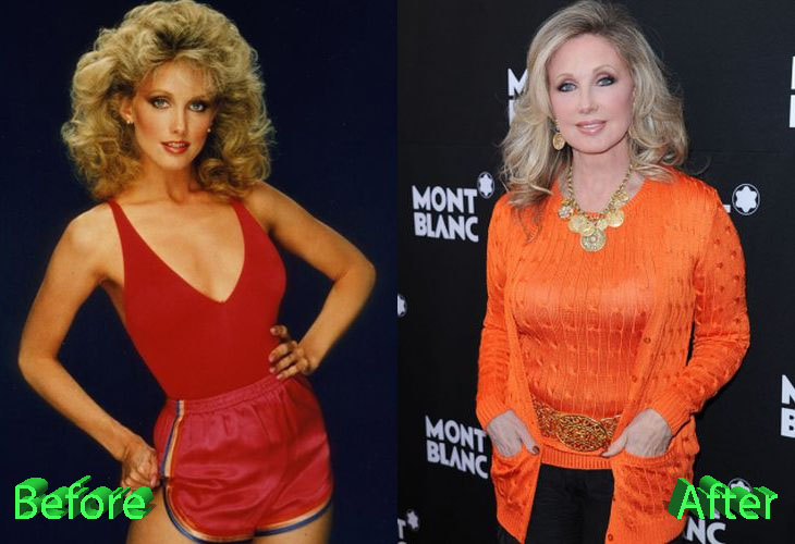 Morgan Fairchild Before and After