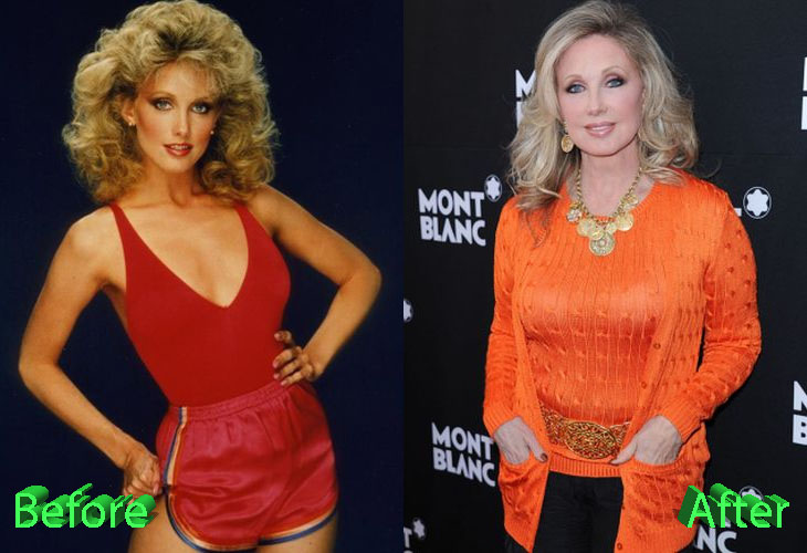Morgan Fairchild Plastic Surgery A Beautiful Soap Opera Queen