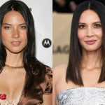 Olivia Munn Before and After Cosmetic Surgery