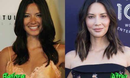 Olivia Munn Plastic Surgery: An Improvement Or Not?