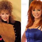 Reba McEntire Before and After Cosmetic Surgery 150x150