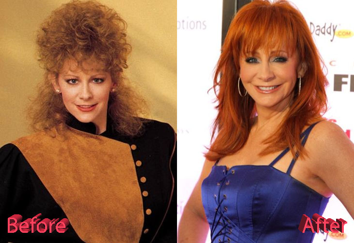 Reba McEntire Plastic Surgery: Looking Just Right