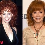 Reba McEntire Before and After Plastic Surgery 150x150
