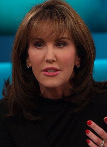 Robin McGraw After Cosmetic Surgery