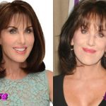 Robin McGraw Before and After Cosmetic Surgery 150x150