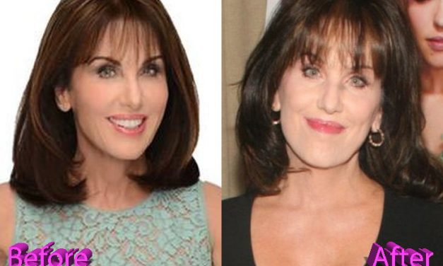 Robin McGraw Plastic Surgery: What She ACTUALLY Admits To! 💉