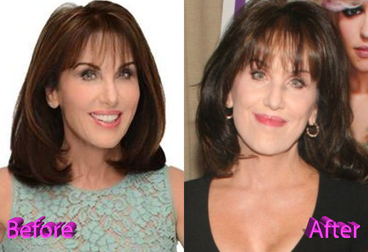 Reasons Why Robin McGraw Plastic Surgery Rumors Could Be True