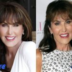 Robin McGraw Before and After Plastic Surgery 150x150