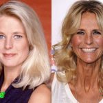 Ulrika Jonsson Before and After Plastic Surgery 150x150