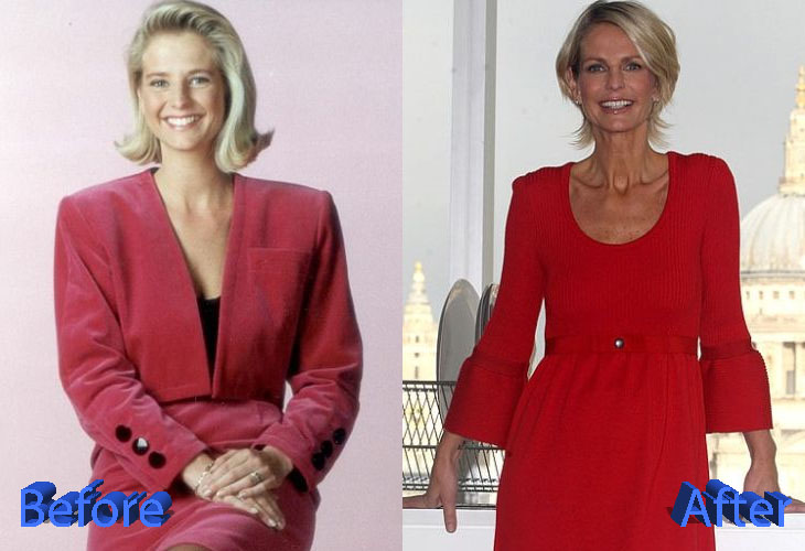 Ulrika Jonsson Before and After