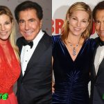 Andrea and Steve Wynn Before and After Plastic Surgery 150x150