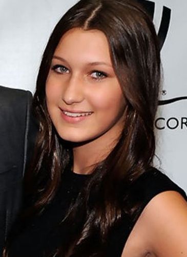 Bella Hadid Before Cosmetic Surgery