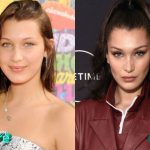 Bella Hadid Before and After Plastic Surgery 150x150