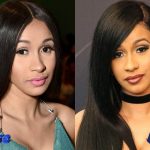 Cardi B Before and After Cosmetic Surgery 150x150