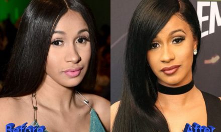 Cardi B Plastic Surgery: A New Look For A New Life