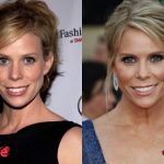 Cheryl Hines Before and After Cosmetic Surgery