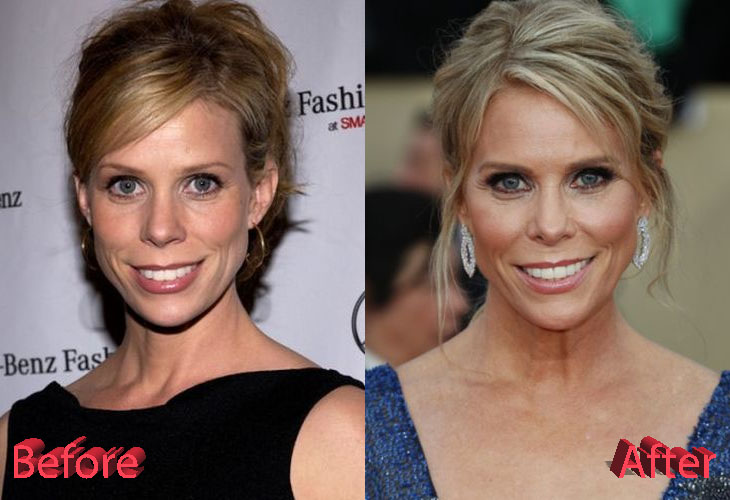 Cheryl Hines Plastic Surgery: Looking Gorgeous As Ever