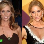 Cheryl Hines Before and After Plastic Surgery